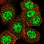Immunofluorescent staining of human cell line MCF7 shows localization to nucleoplasm.