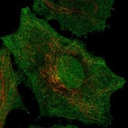 Immunofluorescent staining of human cell line SiHa shows localization to nucleoplasm, plasma membrane & centrosome.