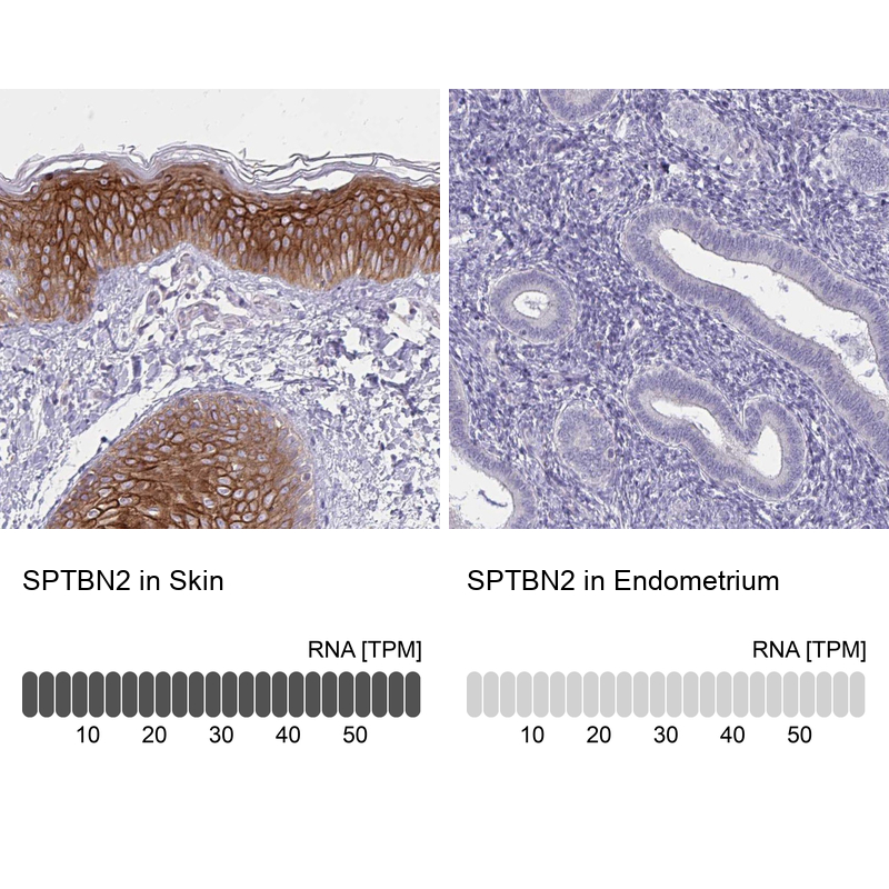 Anti-SPTBN2 Antibody