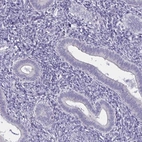 Immunohistochemical staining of human endometrium shows low expression as expected.