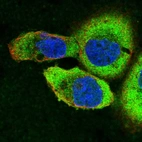 Immunofluorescent staining of human cell line A-431 shows localization to cytosol.