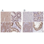 Immunohistochemical staining of human cerebral cortex, colon, pancreas and testis using Anti-STIP1 antibody HPA039291 (A) shows similar protein distribution across tissues to independent antibody HPA044062 (B).