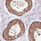 Immunohistochemical staining of human testis shows high expression.