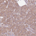 Immunohistochemical staining of human pancreas shows low expression as expected.