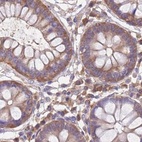 Immunohistochemical staining of human colon using Anti-STIP1 antibody HPA039291.