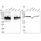 Western blot analysis using Anti-STIP1 antibody HPA039291 (A) shows similar pattern to independent antibody HPA044062 (B).
