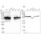 Western blot analysis using Anti-STIP1 antibody HPA039291 (A) shows similar pattern to independent antibody HPA044062 (B).