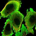 Immunofluorescent staining of human cell line PC-3 shows localization to nucleoplasm & plasma membrane.