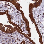 Immunohistochemical staining of human placenta shows strong cytoplasmic positivity in trophoblastic cells.