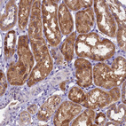 Immunohistochemical staining of human kidney shows moderate cytoplasmic positivity in cells in tubules.