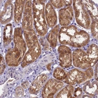Immunohistochemical staining of human kidney shows moderate cytoplasmic positivity in cells in tubules.