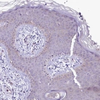 Immunohistochemical staining of human skin shows no positivity in squamous epithelial cells as expected.