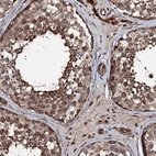 Immunohistochemical staining of human testis shows strong cytoplasmic positivity in cells in seminiferous ducts.