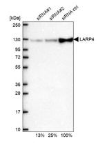Western blot analysis in U2OS cells transfected with control siRNA, target specific siRNA probe #1 and #2, using Anti-LARP4 antibody. Remaining relative intensity is presented.