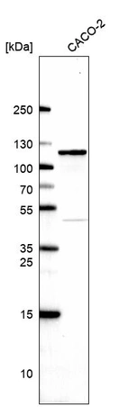 Western blot analysis in human cell line CACO-2.