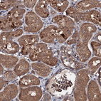 Immunohistochemical staining of human kidney shows strong cytoplasmic positivity in cells in tubules.