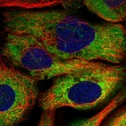 Immunofluorescent staining of human cell line A-431 shows localization to cytosol.