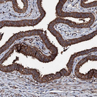 Immunohistochemical staining of human fallopian tube shows strong cytoplasmic positivity in glandular cells.
