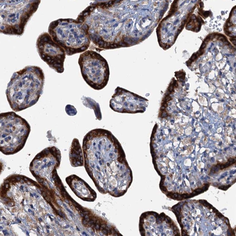 Anti-KDELC2 Antibody