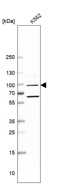 Anti-NAA25 Antibody