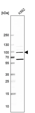 Anti-NAA25 Antibody