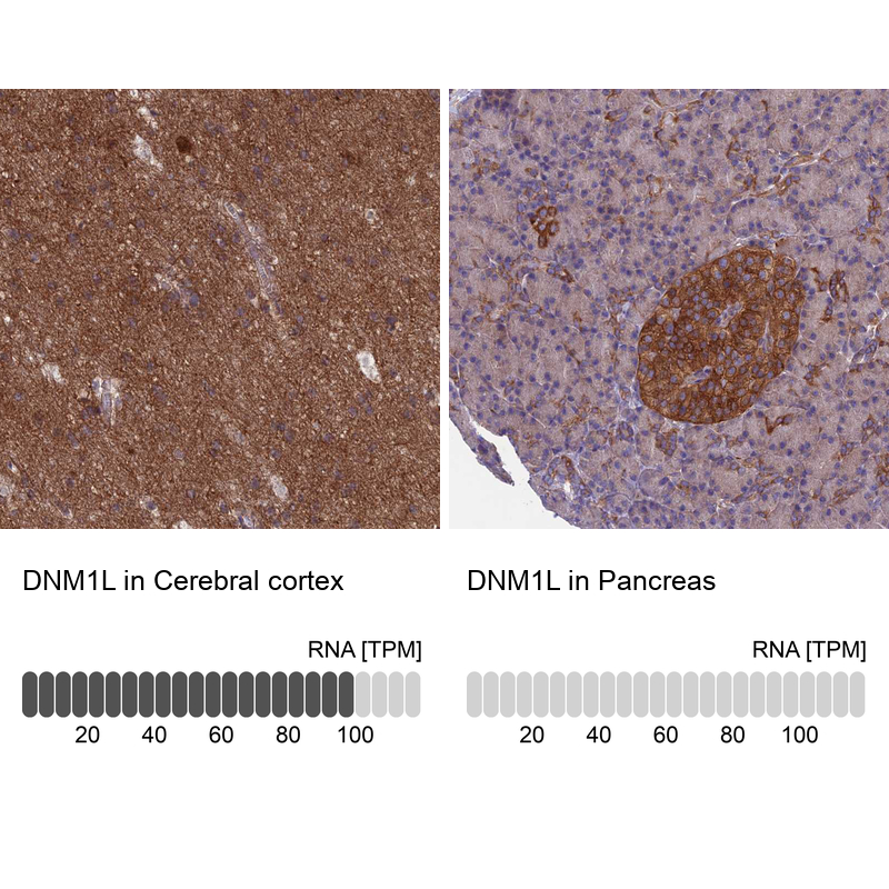 Anti-DNM1L Antibody