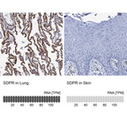 Anti-SDPR Antibody