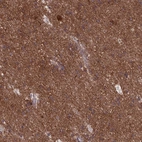 Immunohistochemical staining of human cerebral cortex shows strong cytoplasmic positivity in neurons.