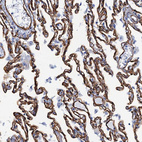 Anti-SDPR Antibody