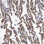 Immunohistochemical staining of human lung shows strong membranous positivity in pneumocytes.