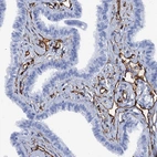 Immunohistochemical staining of human Fallopian tube shows strong membranous positivity in endothelial cells.