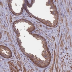 Immunohistochemical staining of human prostate shows strong cytoplasmic positivity in glandular cells.