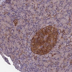 Immunohistochemical staining of human pancreas shows strong cytoplasmic positivity in islets of Langerhans.