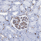 Immunohistochemical staining of human kidney shows strong membranous positivity in cells in glomeruli.