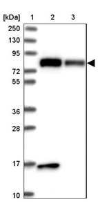 Lane 1: Marker [kDa] 250, 130, 95, 72, 55, 36, 28, 17, 10_br/_Lane 2: Human cell line RT-4_br/_Lane 3: Human cell line U-251MG sp