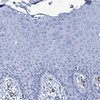 Immunohistochemical staining of human skin shows no positivity in squamous epithelial cells.