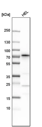Western blot analysis in human cell line HEL.