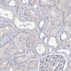 Anti-HVCN1 Antibody