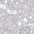 Immunohistochemical staining of human kidney shows low expression as expected.