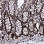 Anti-GALNT11 Antibody