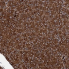 Anti-RNF214 Antibody