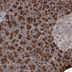 Anti-NUDT22 Antibody
