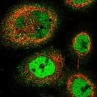 Immunofluorescent staining of human cell line A-431 shows localization to nucleoplasm.