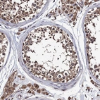 Anti-PPTC7 Antibody