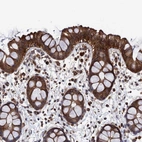 Immunohistochemical staining of human rectum shows strong granular cytoplasmic positivity in glandular cells.