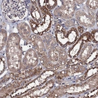 Immunohistochemical staining of human kidney shows strong granular cytoplasmic positivity in cells in tubules.
