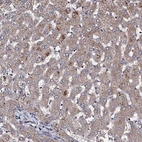 Immunohistochemical staining of human liver shows moderate granular cytoplasmic positivity in hepatocytes.