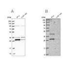 Western blot analysis using Anti-PPTC7 antibody HPA039335 (A) shows similar pattern to independent antibody HPA040614 (B).