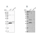 Western blot analysis using Anti-PPTC7 antibody HPA039335 (A) shows similar pattern to independent antibody HPA040614 (B).