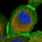 Immunofluorescent staining of human cell line A-431 shows localization to plasma membrane & cytosol.